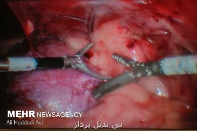 قیمت ربات جراحی از دور ایرانی یك سوم نمونه آمریكایی است