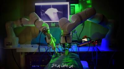 ربات جراح عمل لاپاراسکوپی را با کمترین دخالت انسان انجام داد