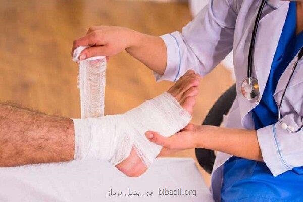 تولید پانسمان های نانویی برای ترمیم زخم های دیابتی